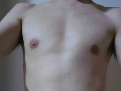 Patrick_ free live xxx cams